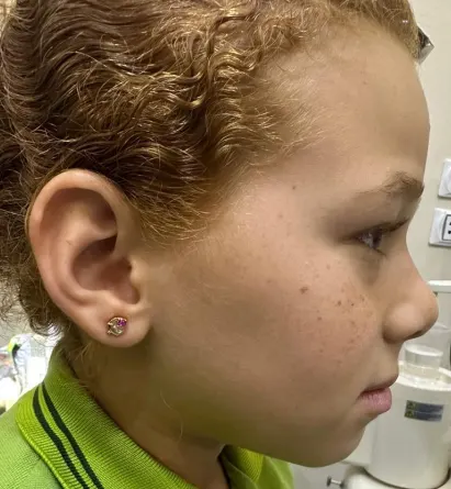 Patient face after treatment