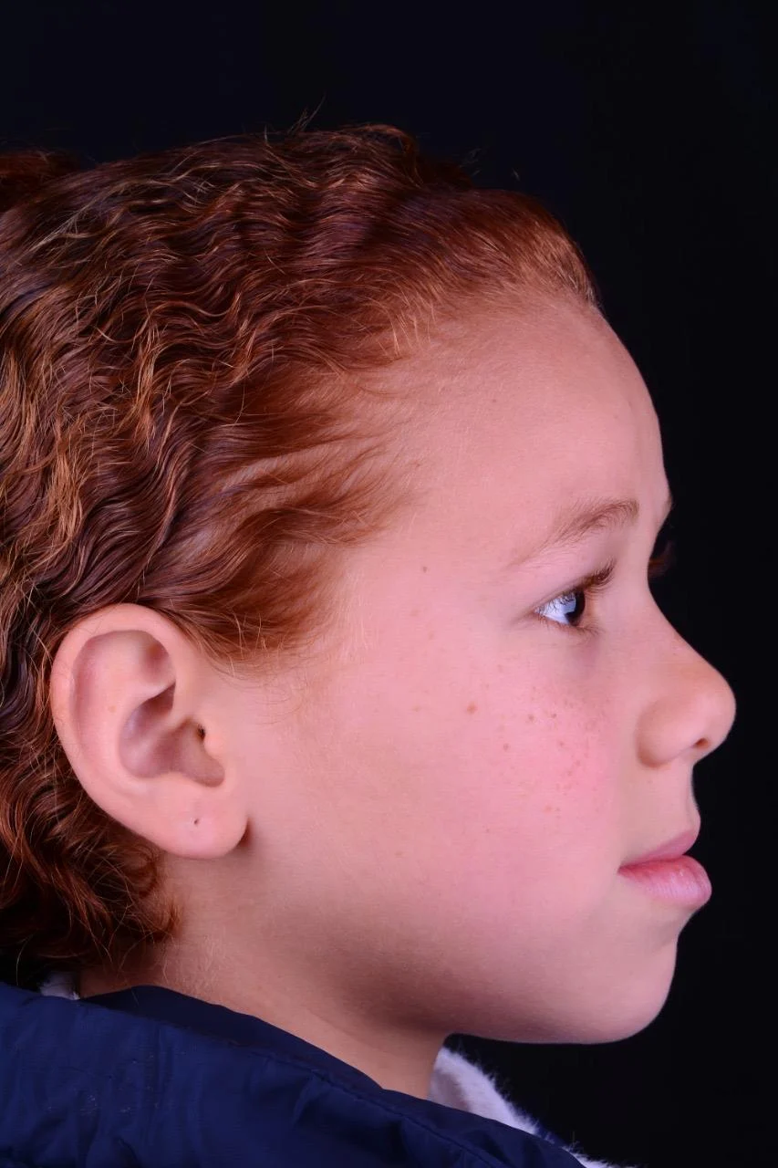 Patient face before treatment