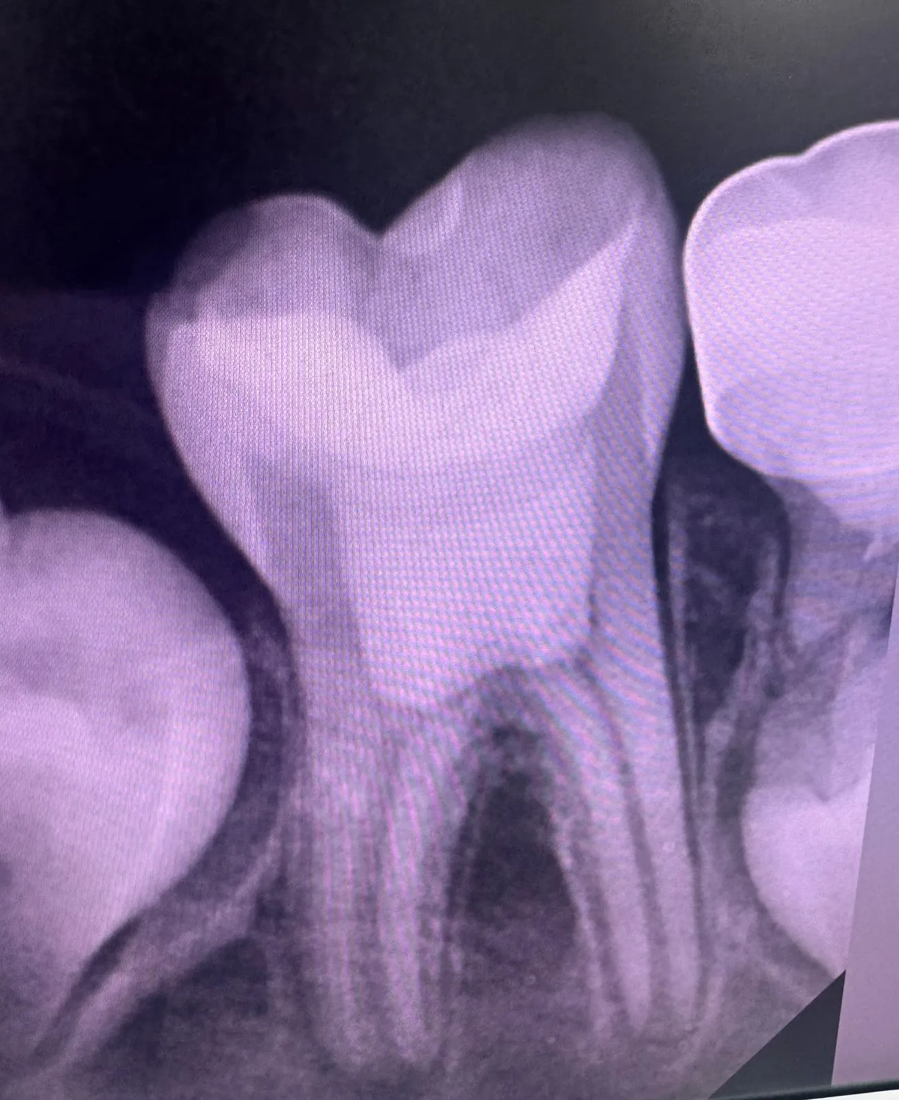 After treatment