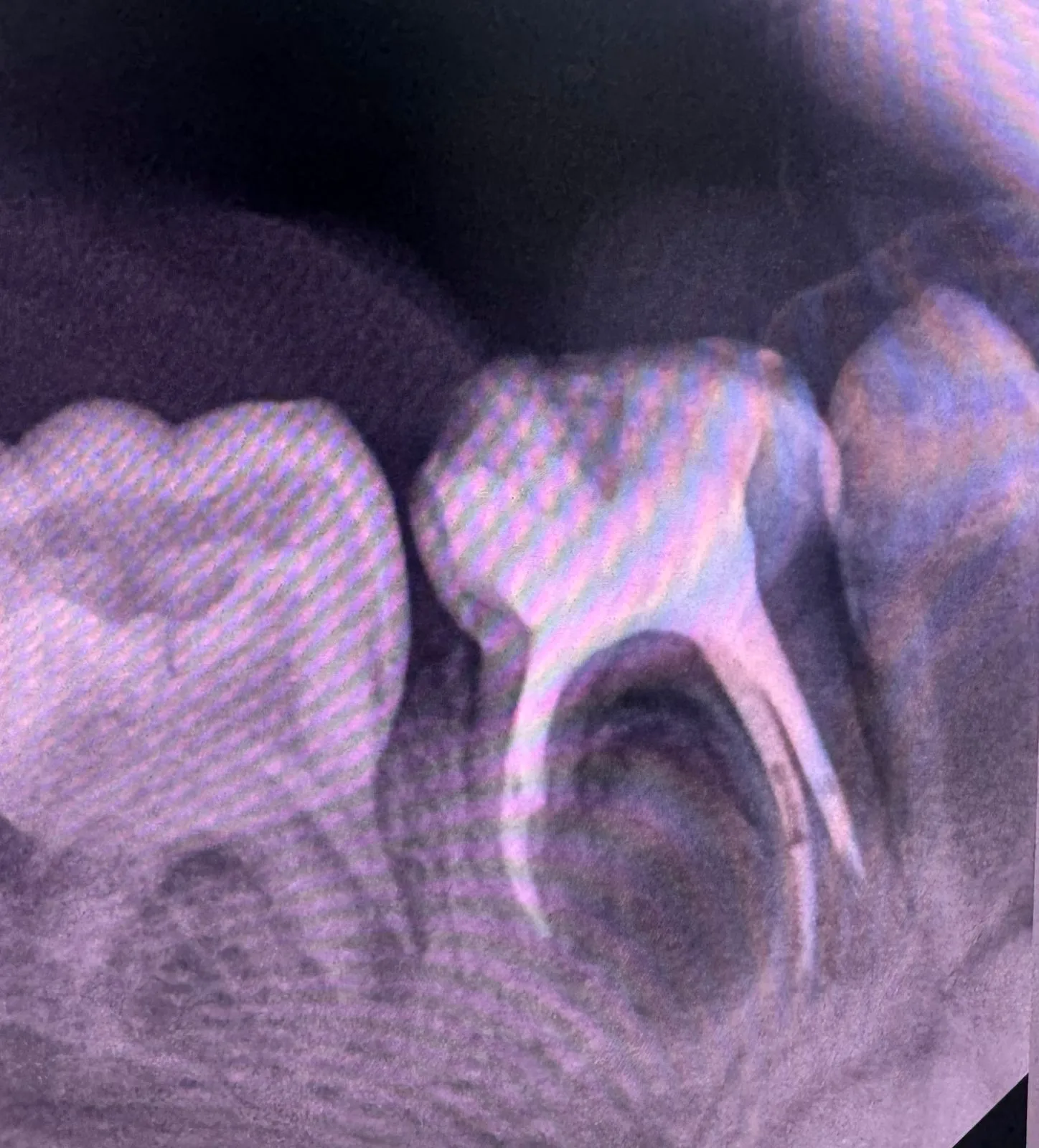 After treatment