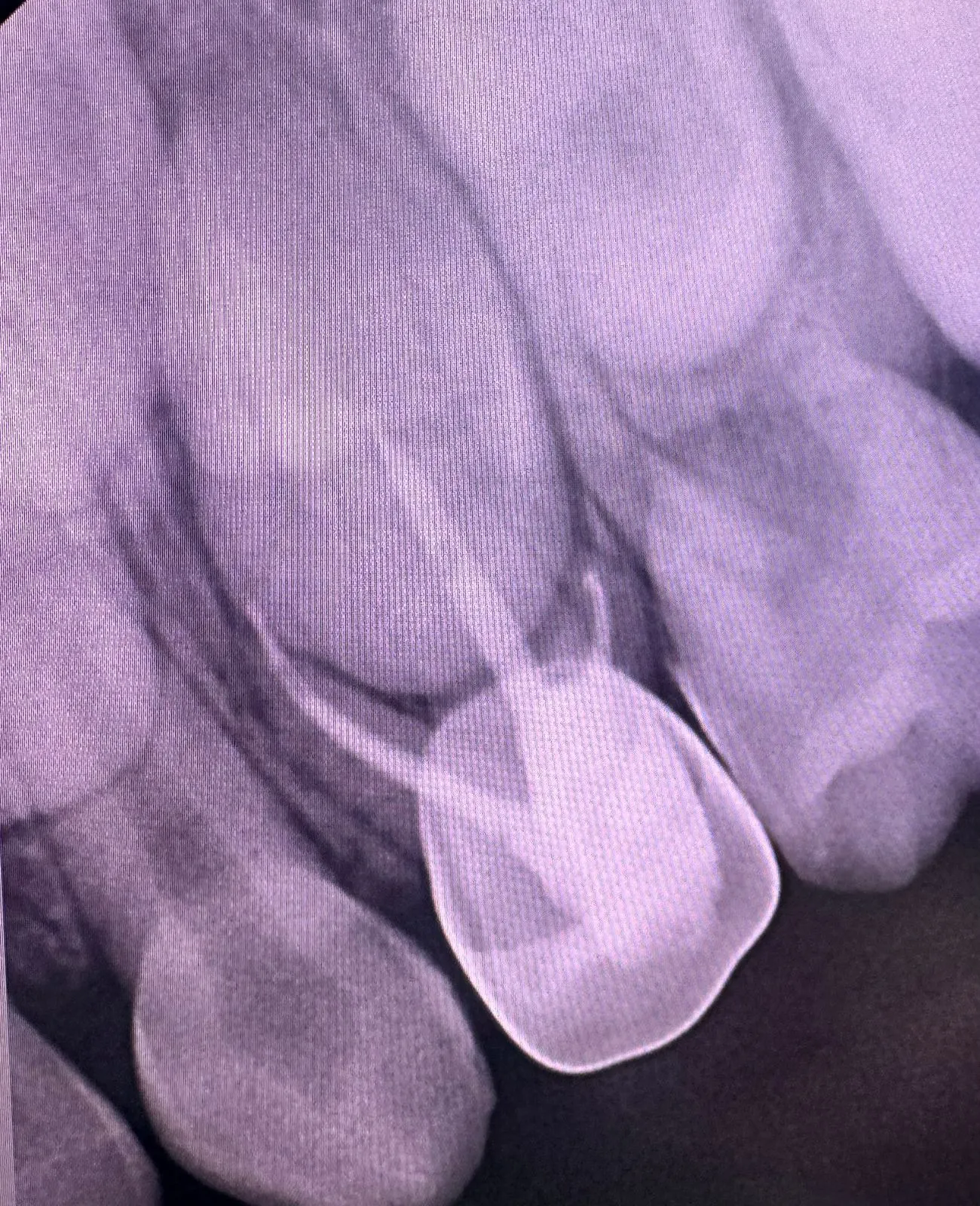 After treatment