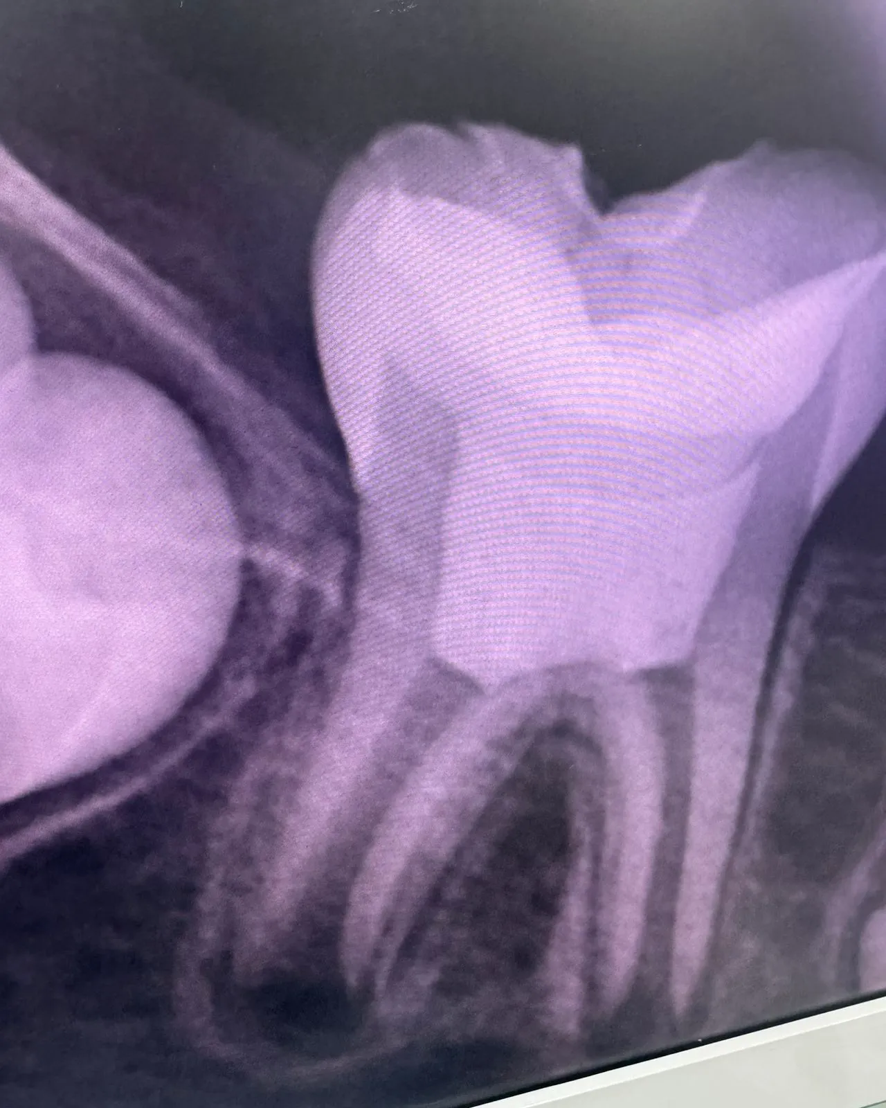 Before treatment