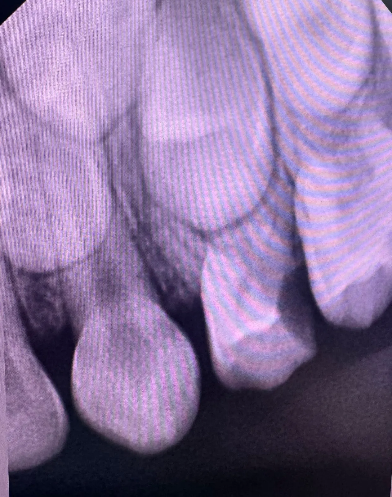 Before treatment