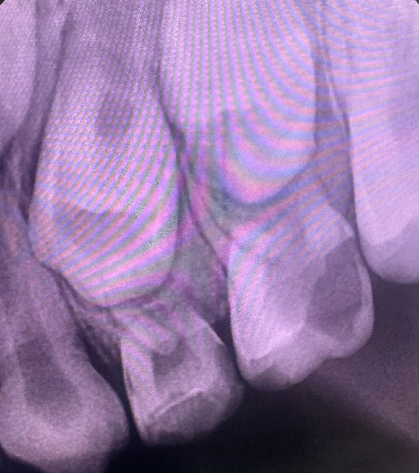 Before treatment