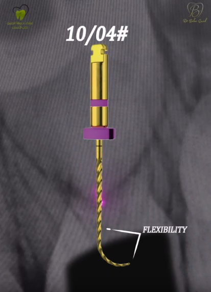 Pulpectomy of Upper D
