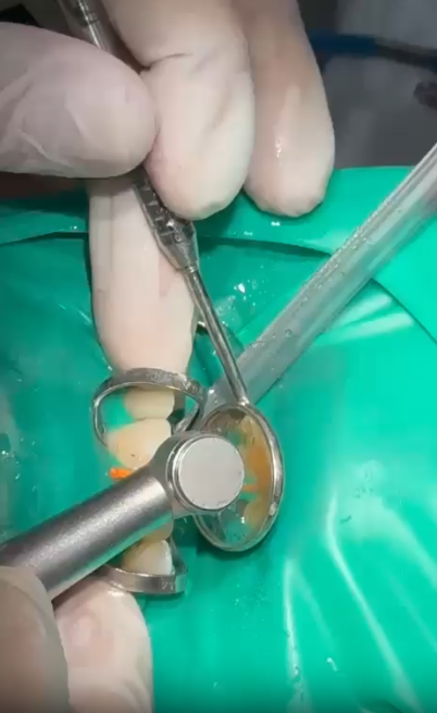 Gentle Pediatric Cleaning